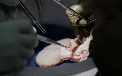 Pig Kidney Works Inside Of Donated Body For Over A Month oan