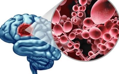 Fungal Infection In The Brain Produces Effects Similar To Alzheimer’s