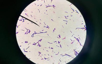 COVID-19 mRNA Vaccines Reduce A Major Beneficial Bacteria, Gut Biodiversity: Research