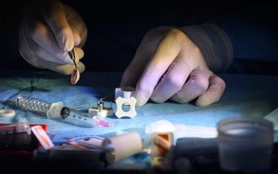 Man Receives World’s First Whole-Eye And Partial Face Transplant  oan