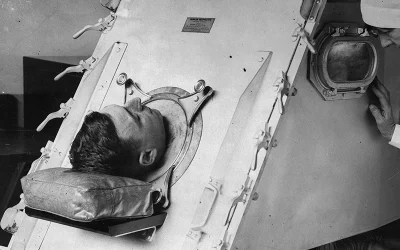 Paul Alexander, Man With Polio Forced Into Iron Lung In 1952, Passes Away At 78 oan