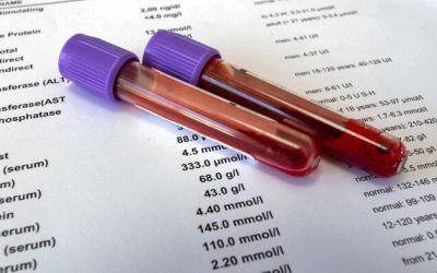 Understanding Lab Tests For Optimal Health