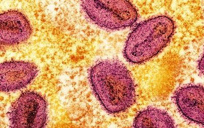 WHO Official: Monkeypox Is Not The New COVID-19, Lockdowns Not Likely
