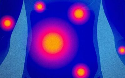 Inflammation: The Body’s ‘Fire’ Burns Threats, But Things Go Wrong When It Smolders
