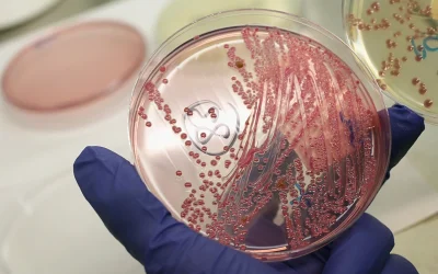 167,000 Lbs Of Ground Beef Products In U.S. Recalled Due To ‘Possible’ E. Coli Contamination oan