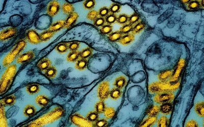 WHO Says Bird Flu Risk Low After 1st H5N1 Death In US