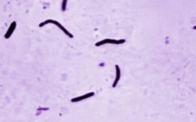 Tuberculosis Outbreaks Emerge As Illegals Pose Biosecurity Threat For Nation