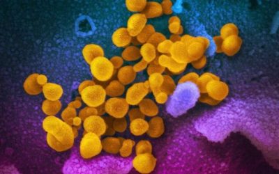COVID ‘Razor Throat’ Variant Now Found In 15 US States: Here’s What We Know