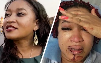Black Woman Who Left US For Russia To “Escape Racism” Beaten By New Neighbors