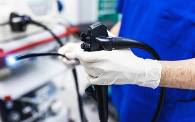 Colorectal Cancer Rising Among People Under 50: American Medical Association