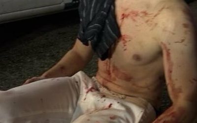 DOGE Worker “Big Balls” Bloodied After DC Attack; Trump, Musk Call To Federalize DC 