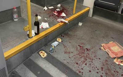 American Knifed In Face By Syrian After Intervening To Protect Women On German Train