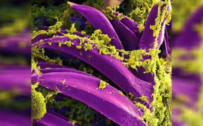 New Mexico Man Diagnosed With Plague In State's First Case This Year, Say Officials