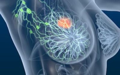 FDA Approves New Therapy For Advanced Breast Cancer