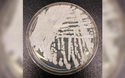 Multidrug-Resistant Fungus Spreading Rapidly In Europe: ECDC