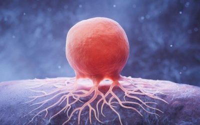 Cancer Is Not Just in Your Genes: Be Aware Of These Key Culprits