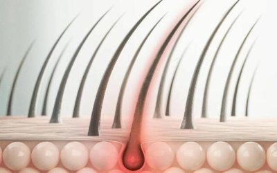 Simple Hair-Test Identifies Children At Highest Risk For Depression And Anxiety