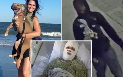 Georgia Woman Attacked With ‘Corrosive’ Chemical After Christmas Event, Suffers Third-Degree Burns